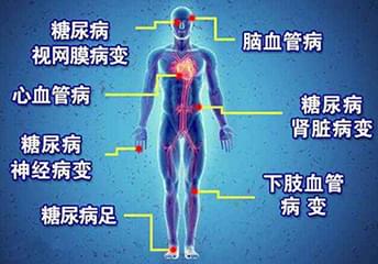 糖尿病并发症概述与治疗