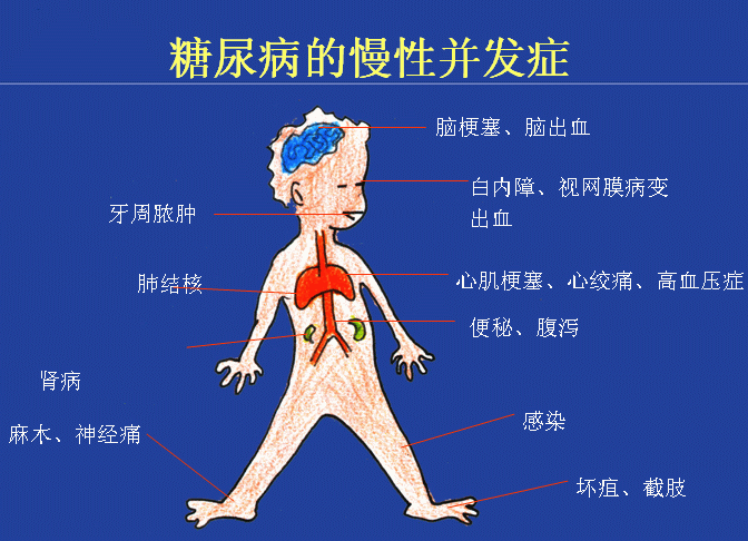 糖尿病