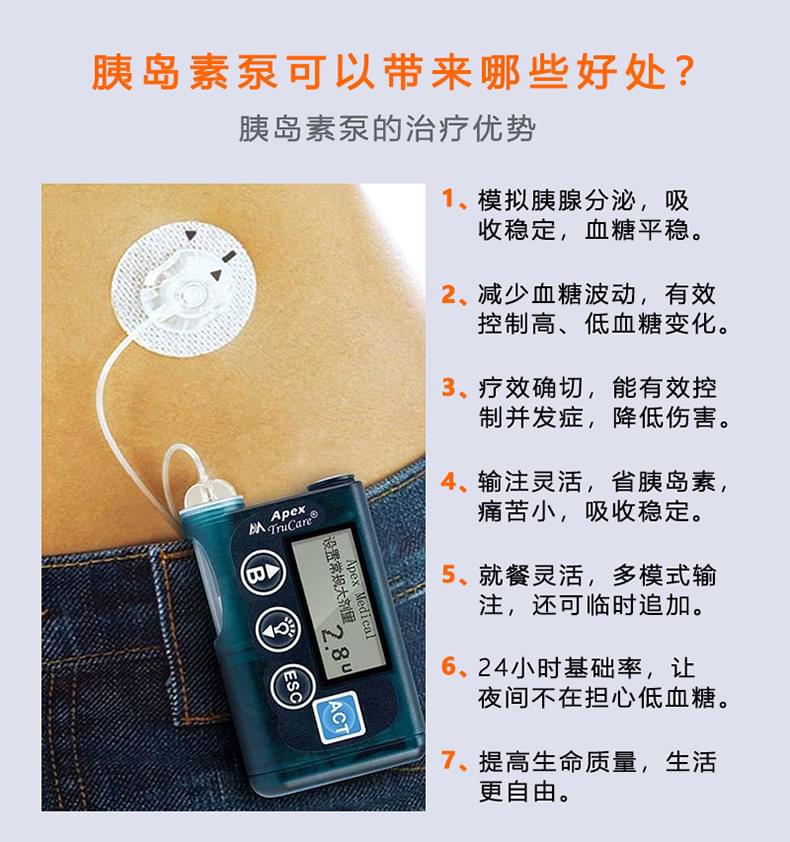 糖尿病强化治疗<a href='http://www.zksip.com/ktzs/ydsbbd/290.html' target='_blank'><u>佩戴胰岛素泵</u></a>的优势好处