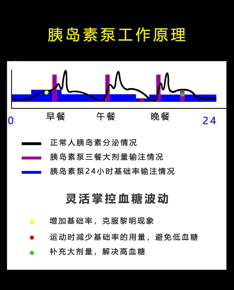 胰岛素泵的工作原理即理论依据